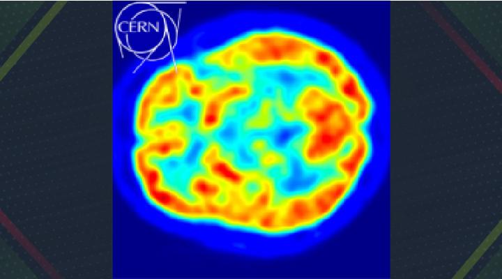 Particle physics on the brain