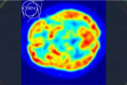 Particle physics on the brain